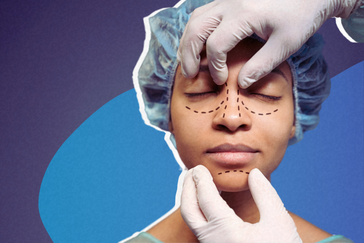 RINOPLASTIA UMA DAS CIRURGIAS PLÁSTICAS MAIS SONHADAS DO BRASIL – FOTO EDITADA